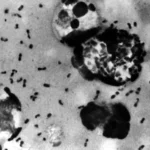 Arizona Resident Dies From Plague That Killed Half of Europe in 14th Century