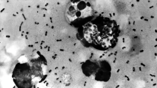 Arizona Resident Dies From Plague That Killed Half of Europe in 14th Century